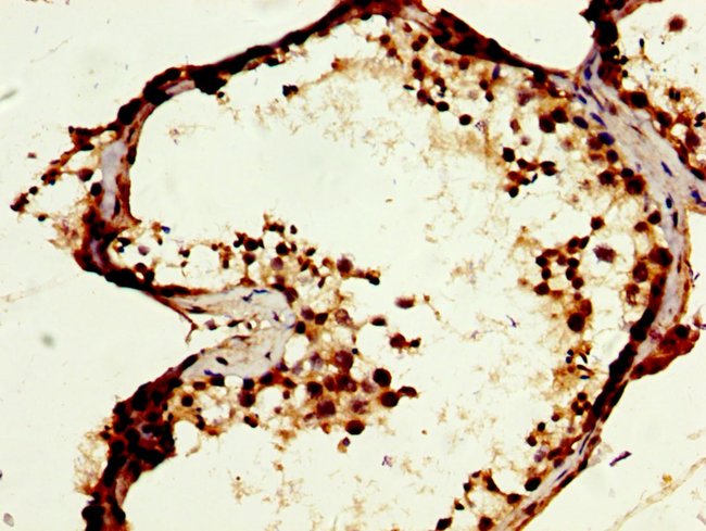 100UG MOS ANTIBODY 100 ug