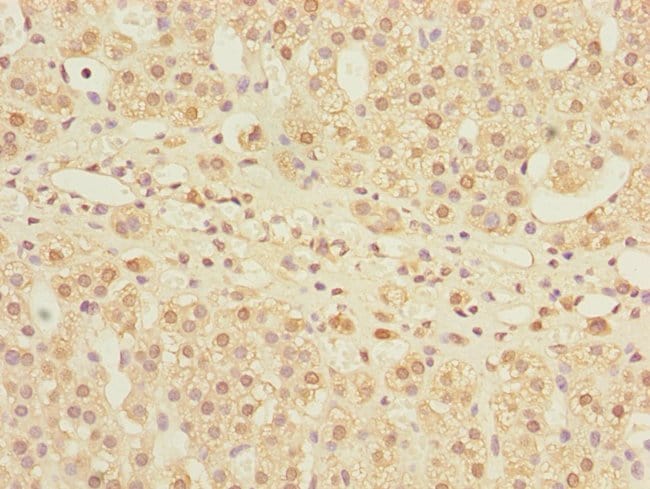 100UL MPI ANTIBODY 100 ul