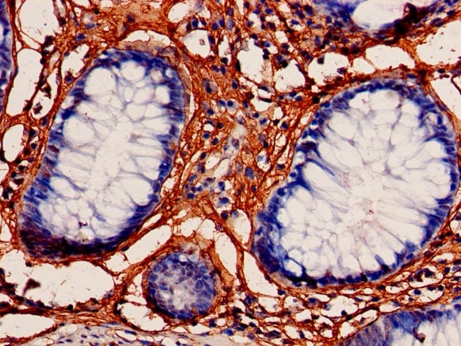 100UG MRPL3 ANTIBODY 100 ug