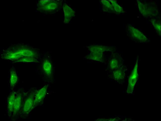 100UG MSH4 ANTIBODY 100 ug