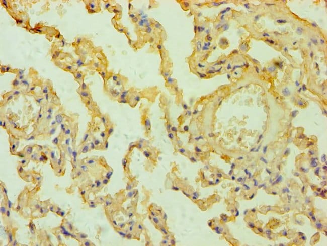 100UL MESOTHELIN ANTIBODY 100 ul