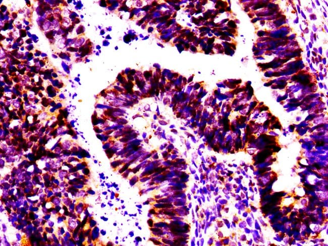100UG MSX2 ANTIBODY 100 ug