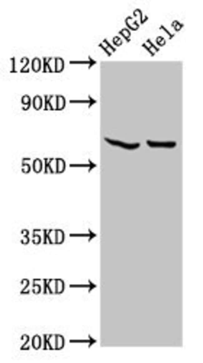 100UG MT-ND5 ANTIBODY 100 ug