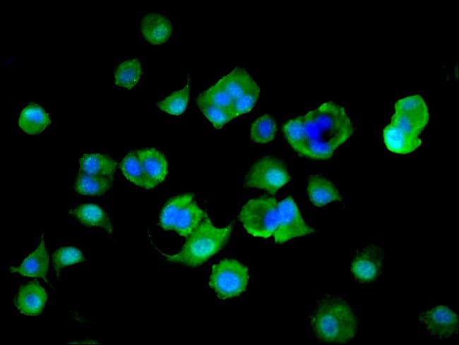 100UG MTHFS ANTIBODY 100 ug