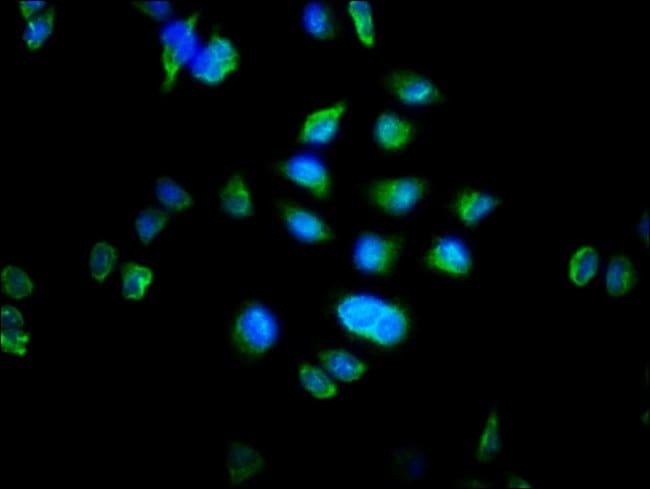 100UG MTRF1 ANTIBODY 100 ug