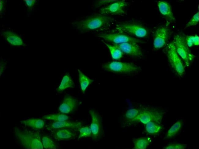 100UG MVD ANTIBODY 100 ug
