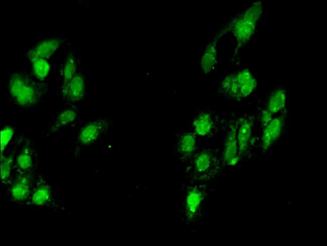 100UG MYF6 ANTIBODY 100 ug