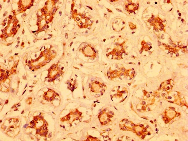 100UG MZF1 ANTIBODY 100 ug