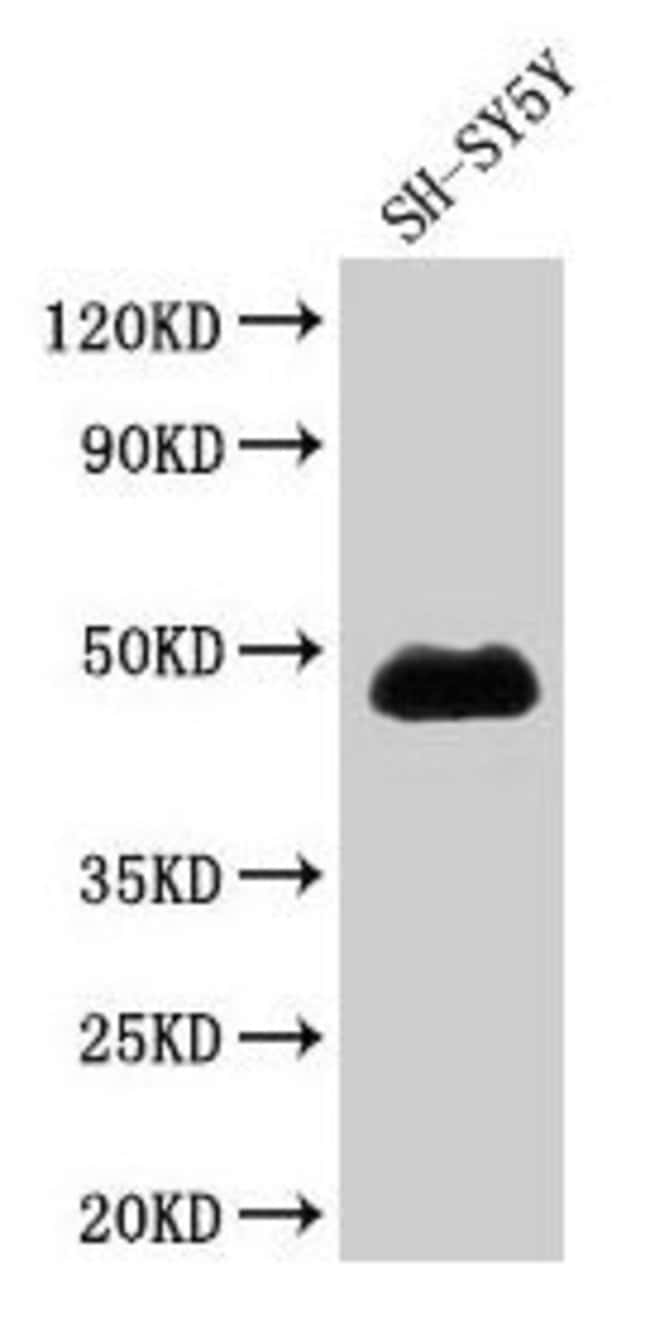 100UG NADK ANTIBODY 100 ug