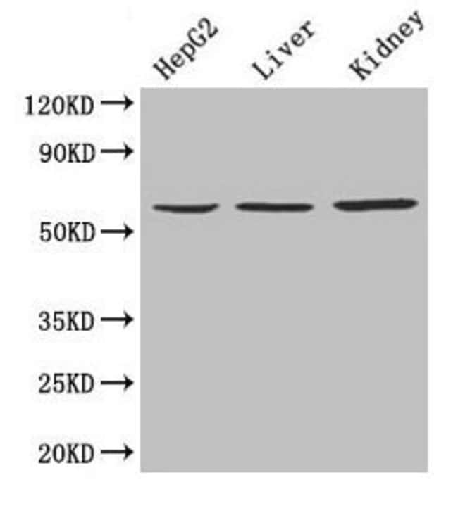 100UG NAPRT1 ANTIBODY 100 ug
