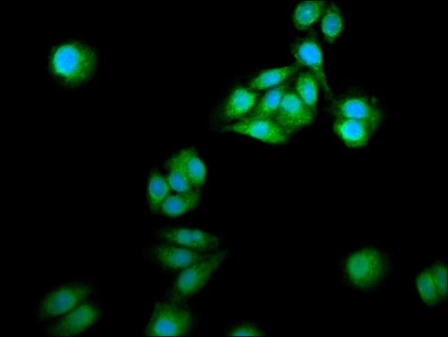 100UG NCDN ANTIBODY 100 ug