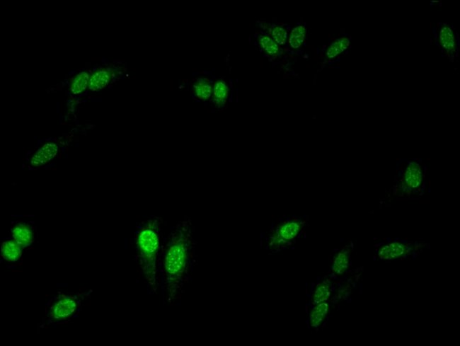 100UG NCF2 ANTIBODY 100 ug
