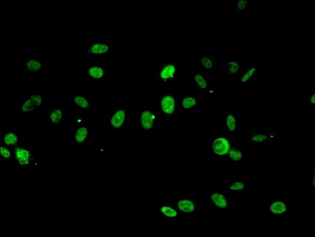 100UG RPA2 ANTIBODY 100 ug