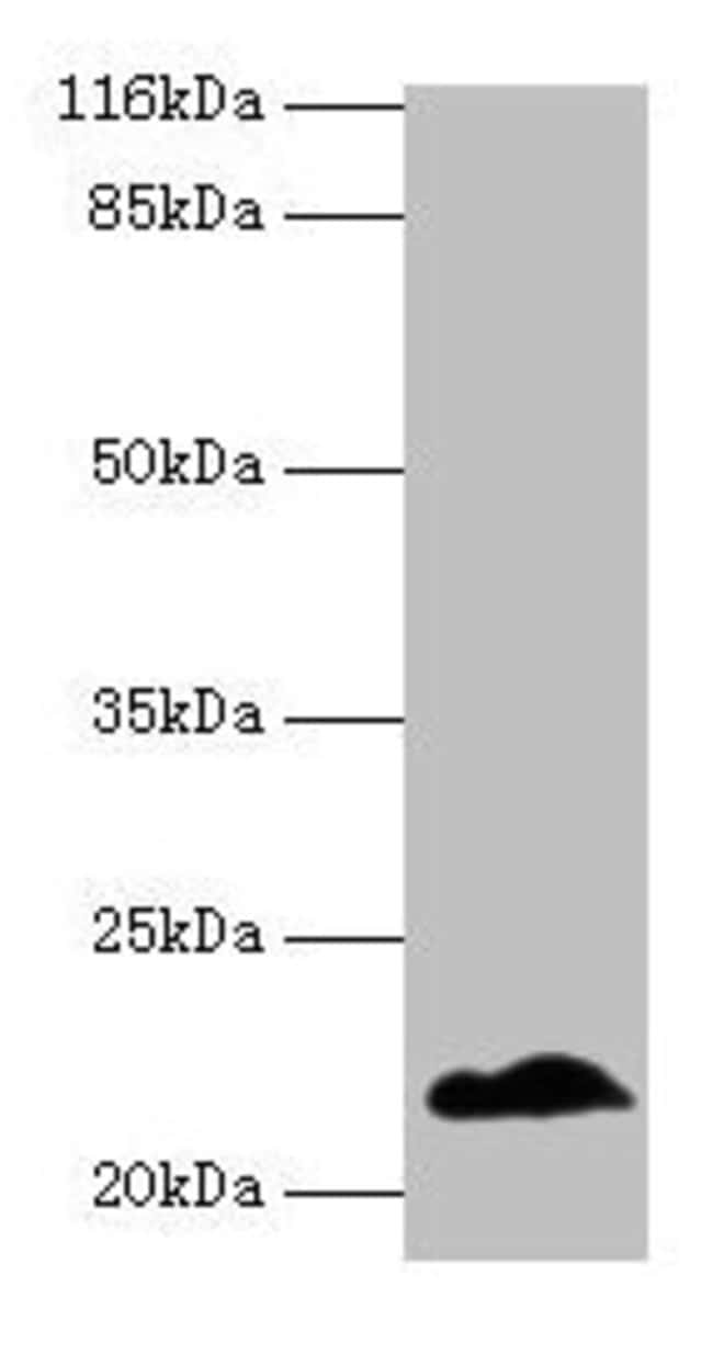 100UG NDUFB5 ANTIBODY 100 ug