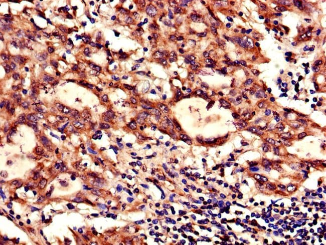 100UG NDUFB6 ANTIBODY 100 ug