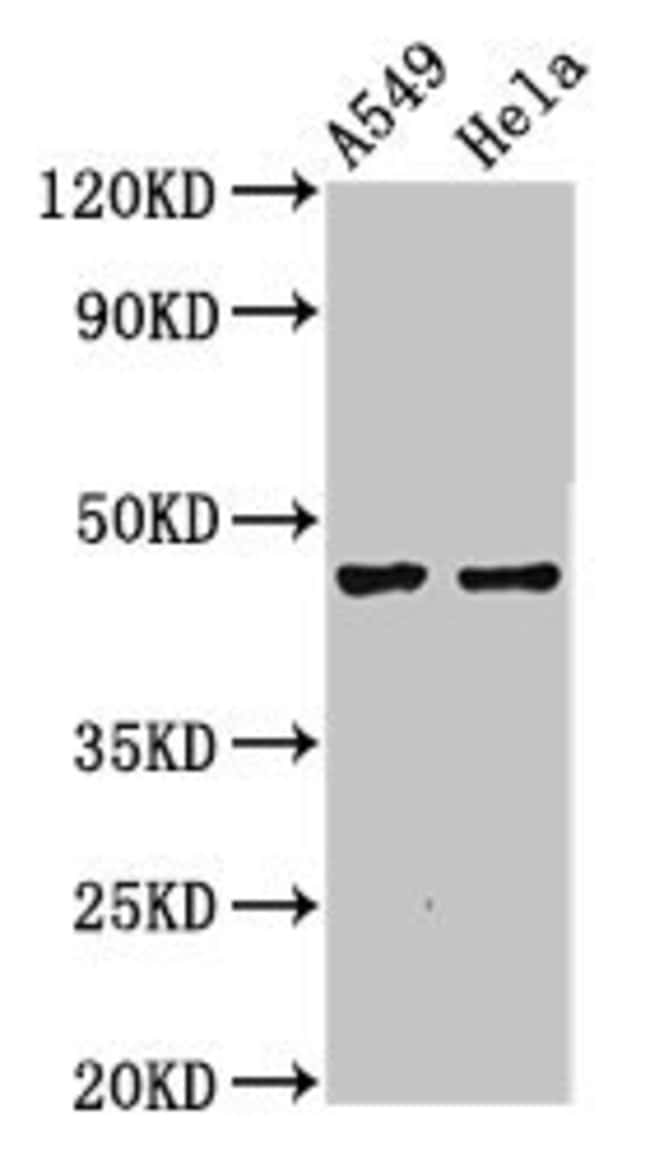 100UG NMBR ANTIBODY 100 ug