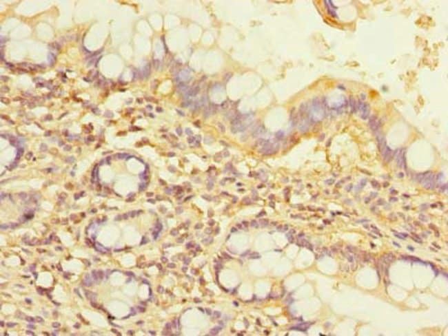 100UG NOL10 ANTIBODY 100 ug