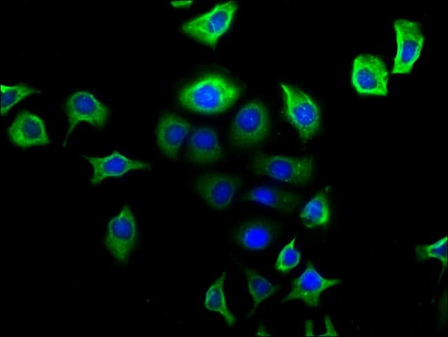 100UG NPY2R ANTIBODY 100 ug