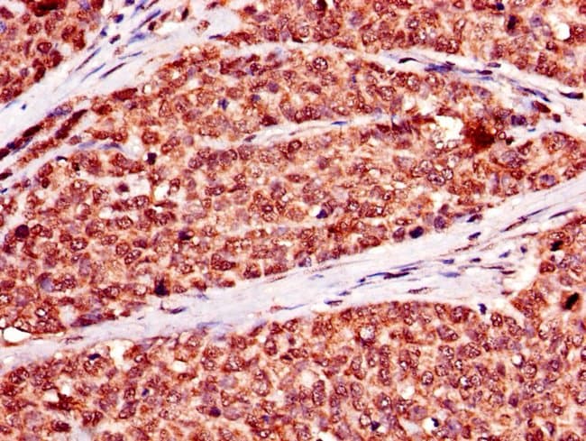 100UG NR2C2AP ANTIBODY 100 ug