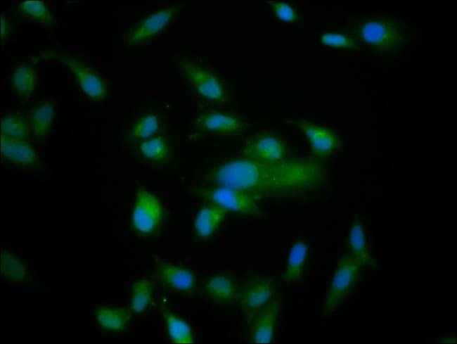 100UG NARDILYSIN ANTIBODY 100 ug