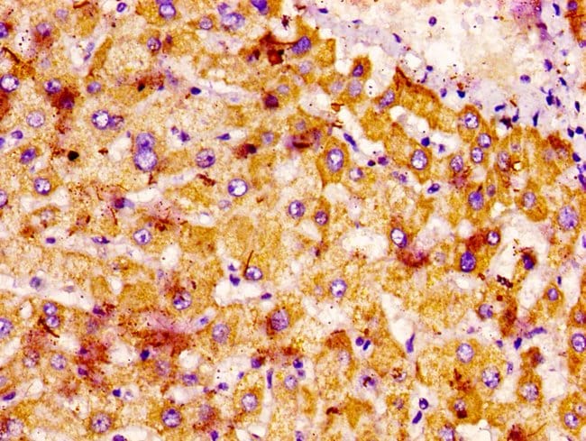 100UG NTN1 ANTIBODY 100 ug