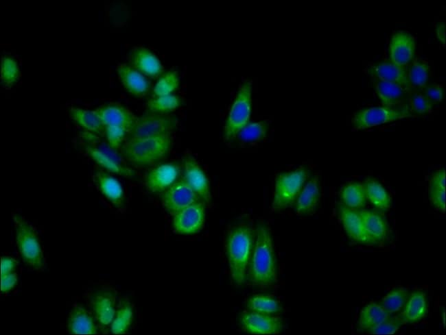 100UG TRKA ANTIBODY 100 ug
