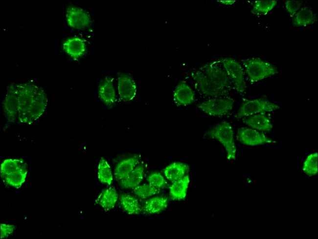 100UG NUDT21 ANTIBODY 100 ug
