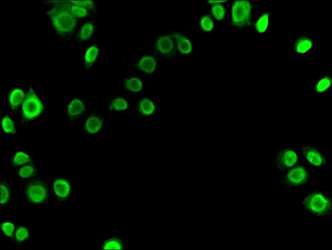 100UG KU70 ANTIBODY 100 ug
