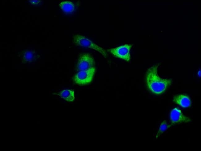 100UG NUMA ANTIBODY 100 ug
