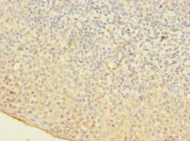 100UG OGG1 ANTIBODY 100 ug