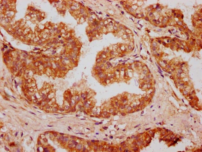 100UG OMD ANTIBODY 100 ug