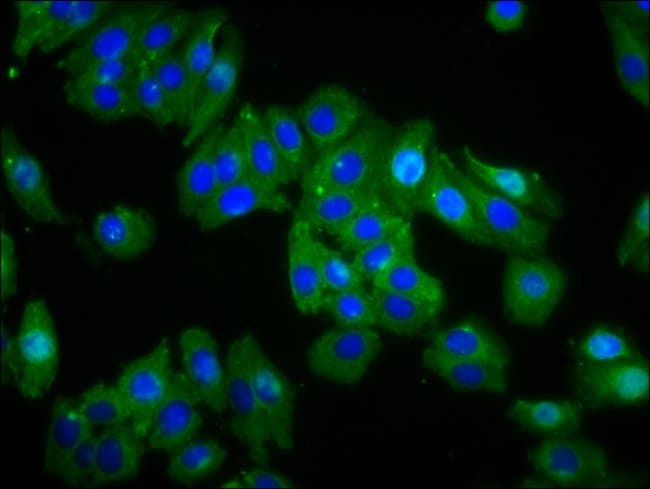 100UG OPSIN GREEN ANTIBODY 100 ug