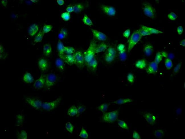 100UG PAM ANTIBODY 100 ug