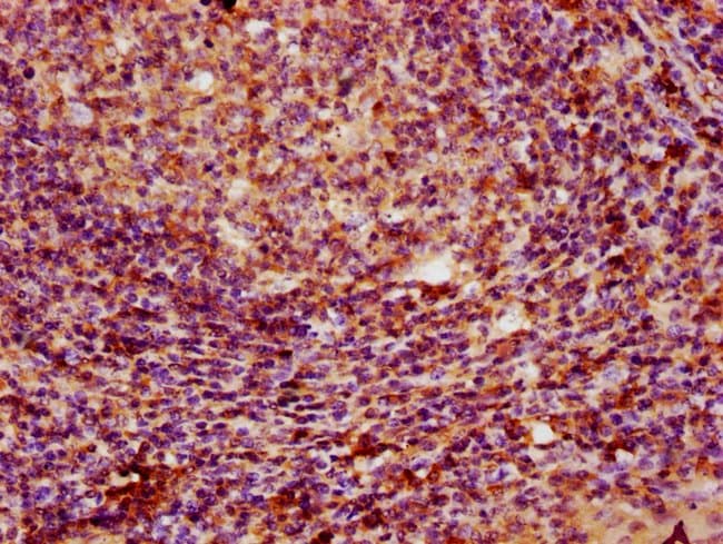 100UG PARP3 ANTIBODY 100 ug