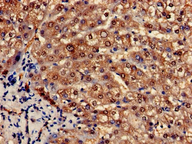 100UG PCCA ANTIBODY 100 ug