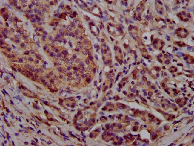 100UG PCCB ANTIBODY 100 ug