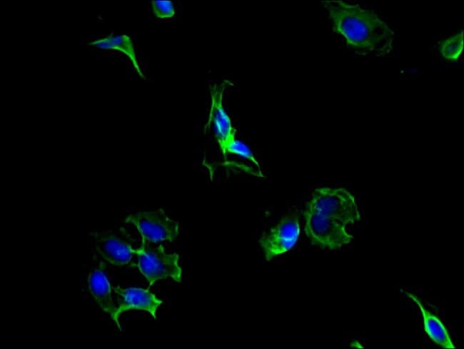 100UG PCSK5 ANTIBODY 100 ug