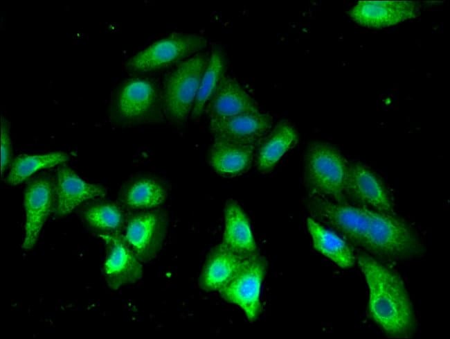 100UG PDE2A ANTIBODY 100 ug