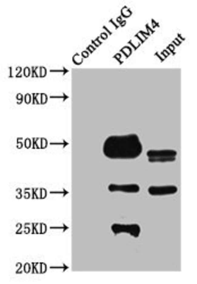 100UG PDLIM4 ANTIBODY 100 ug