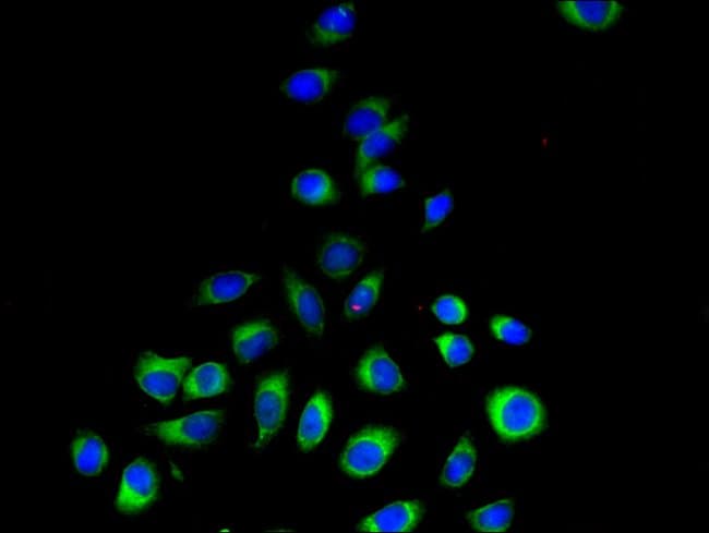 100UG PEMT ANTIBODY 100 ug