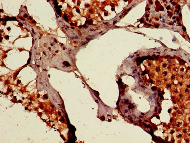 100UG PEPD ANTIBODY 100 ug