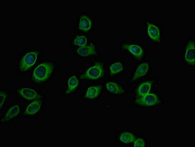 100UG PFKM ANTIBODY 100 ug