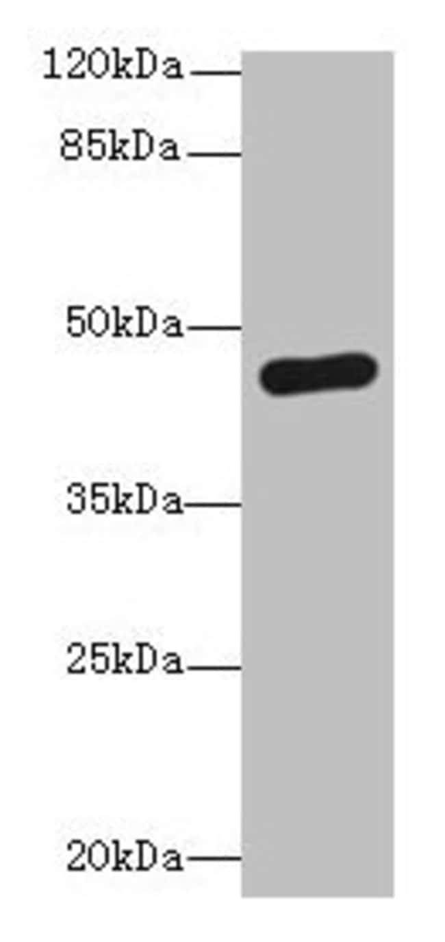 100UG PGK2 ANTIBODY 100 ug