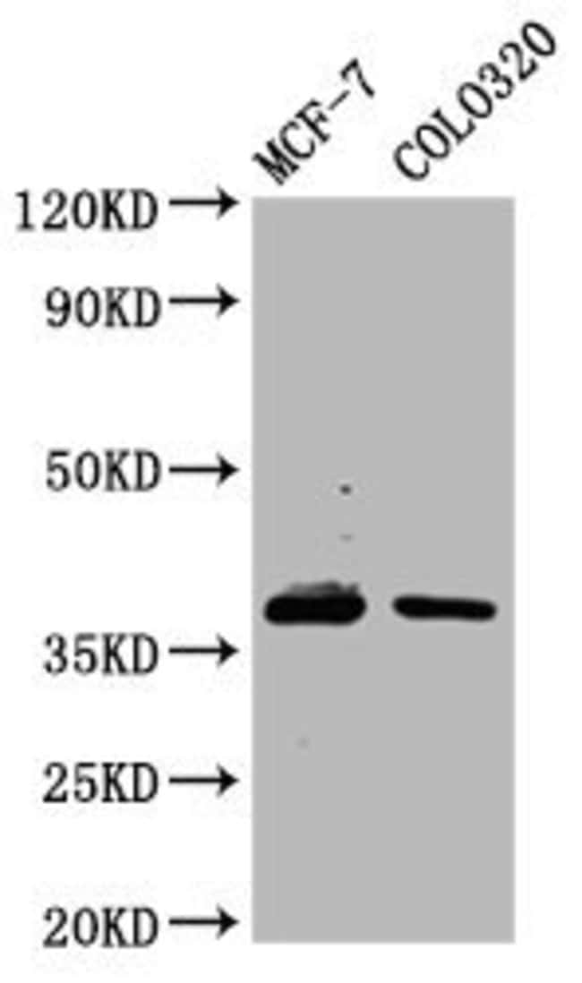 100UG PGRP-1A ANTIBODY 100 ug
