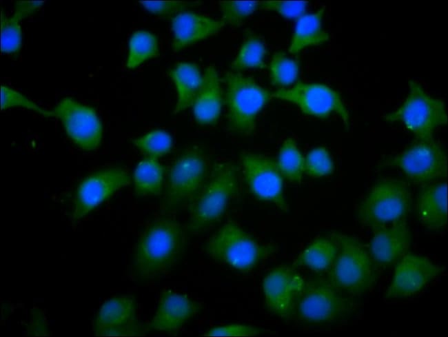 100UG PHACTR1 ANTIBODY 100 ug