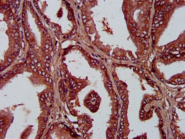 100UG PLA1A ANTIBODY 100 ug