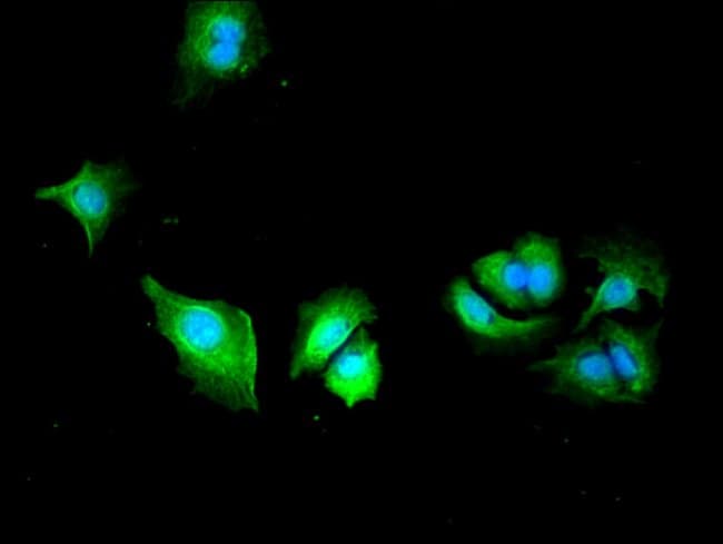 100UG PLS3 ANTIBODY 100 ug
