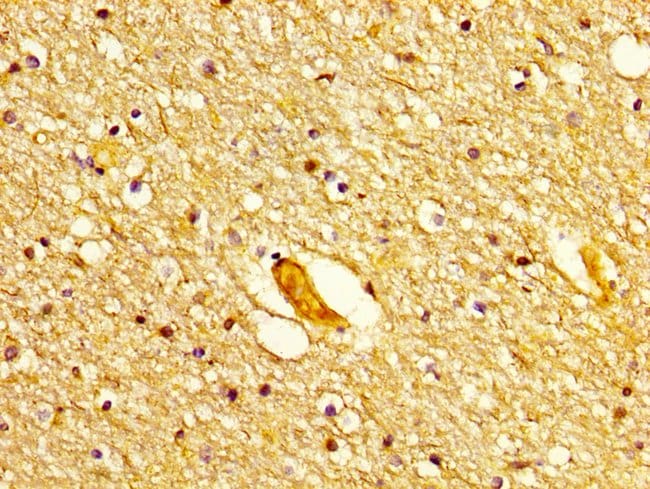 100UG POLD1 ANTIBODY 100 ug