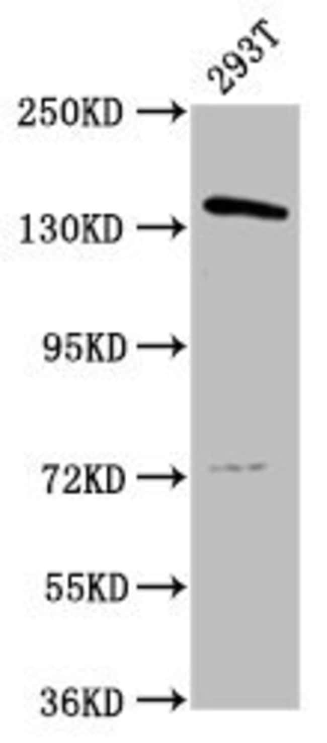 100UG POLG ANTIBODY 100 ug