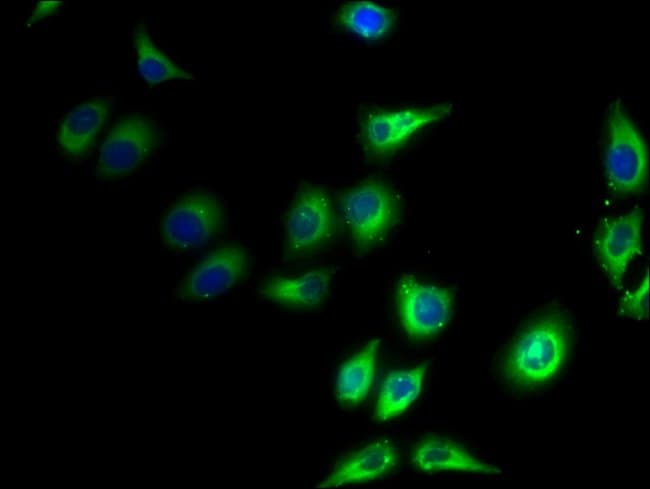 100UG PPAP2C ANTIBODY 100 ug